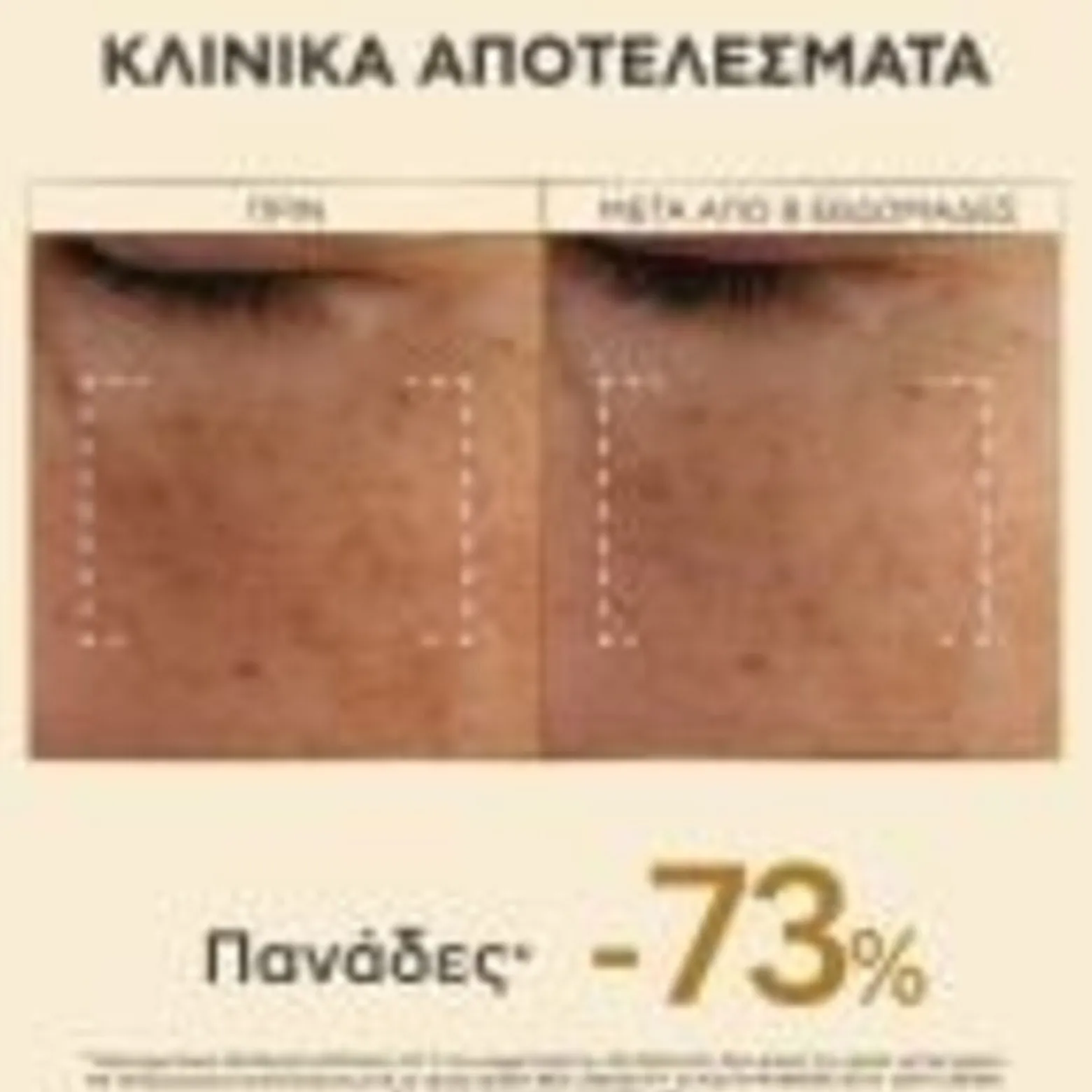 APIVITA Queen Bee Longevity 12 Youth Markers Silky Light Cream 50ml (1.69floz)