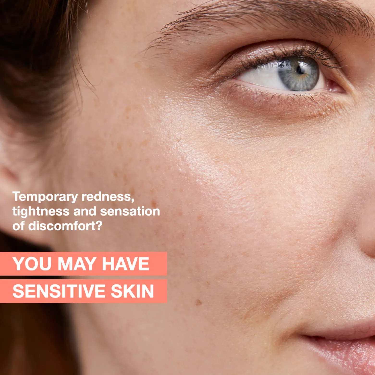 Avène Antirougeurs Rosamed Chronic Redness Concentrate Cream 30ml (1.01floz)