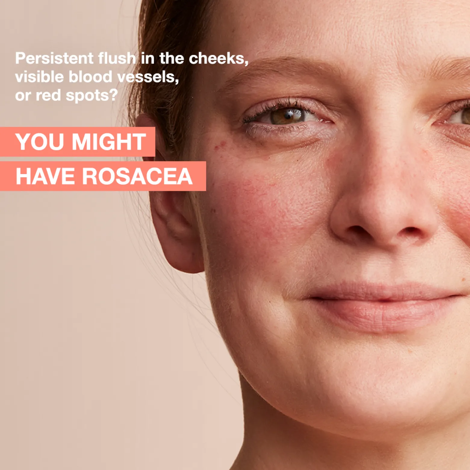 Avène Antirougeurs Rosamed Chronic Redness Concentrate Cream 30ml (1.01floz)