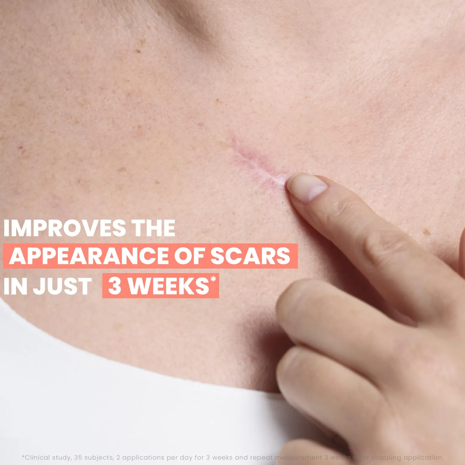 Avène Cicalfate+ Remodeling Scar Gel 40ml (1.3floz)