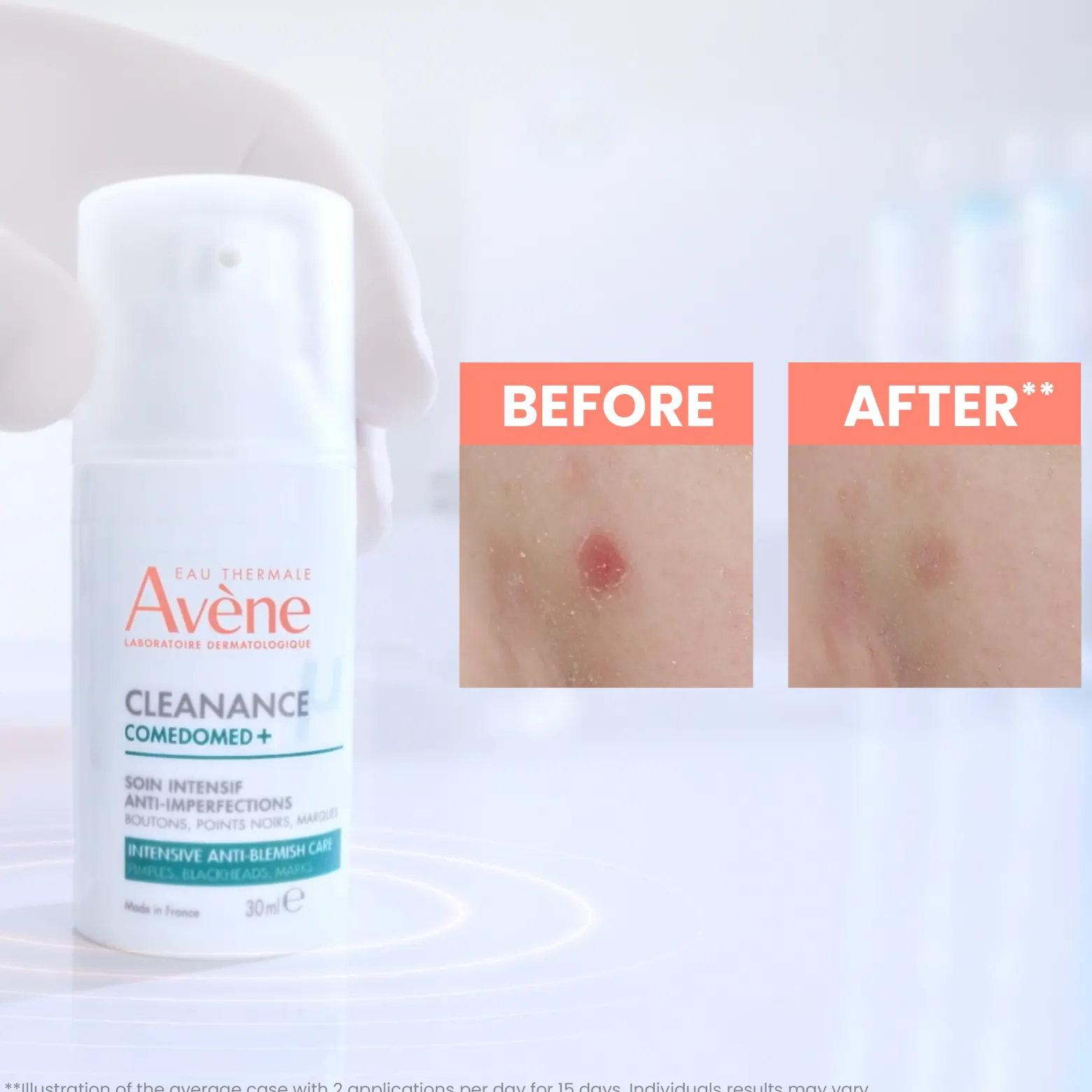 Avène Cleanance Comedomed+ Anti-Imperfections Intensive Care 30ml (1.01floz)