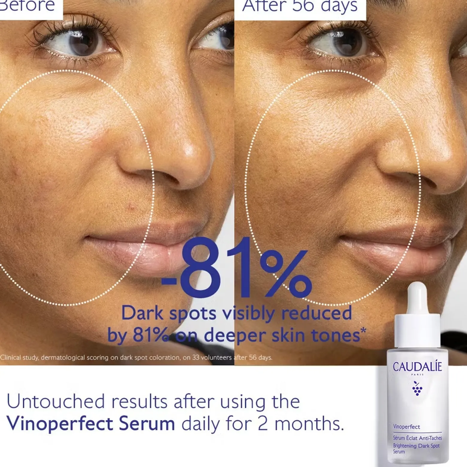 Caudalie Vinoperfect Brightening Dark Spot Serum 30ml (1.01floz)