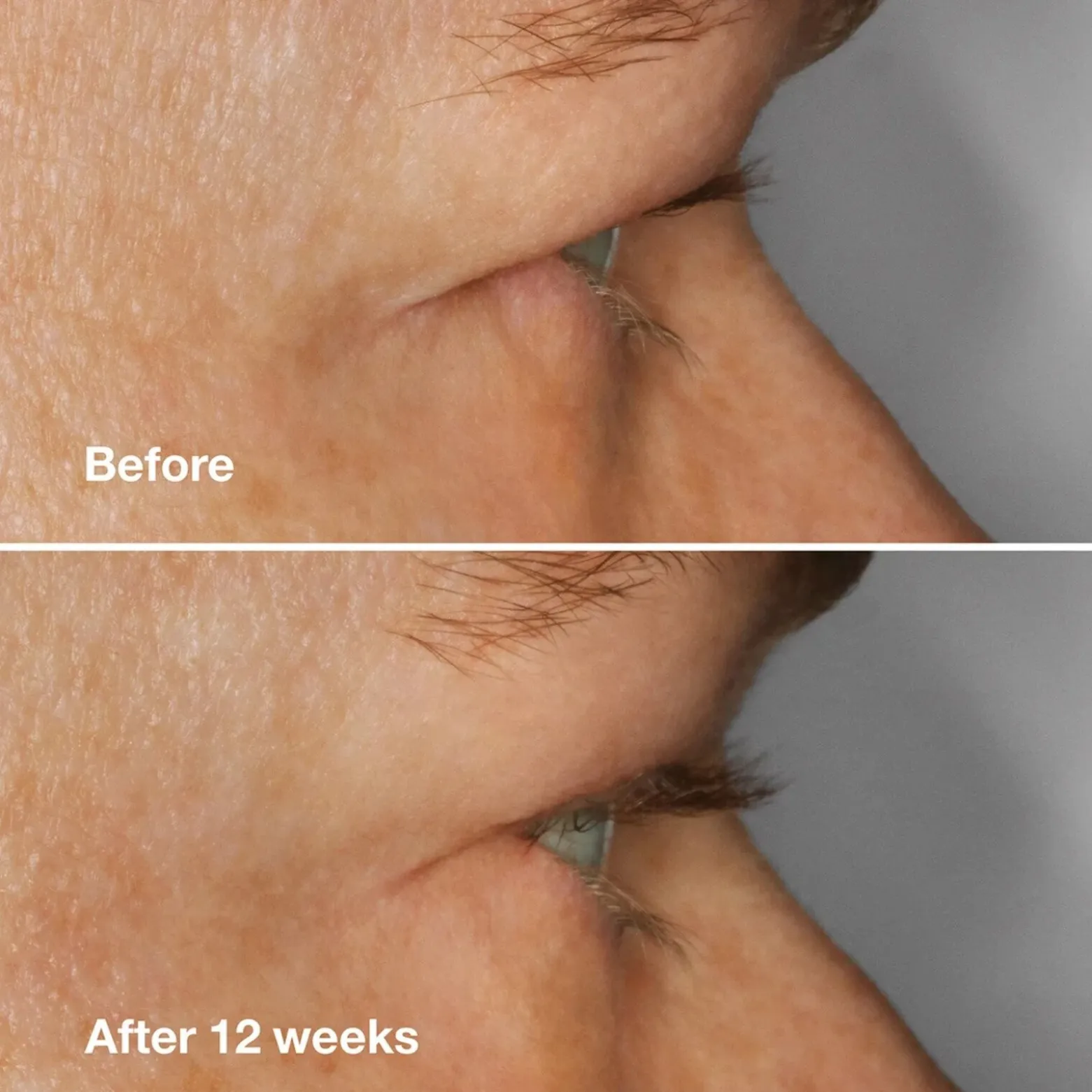 Clinique High Impact Lash Amplifying Serum 3g (0.1floz)
