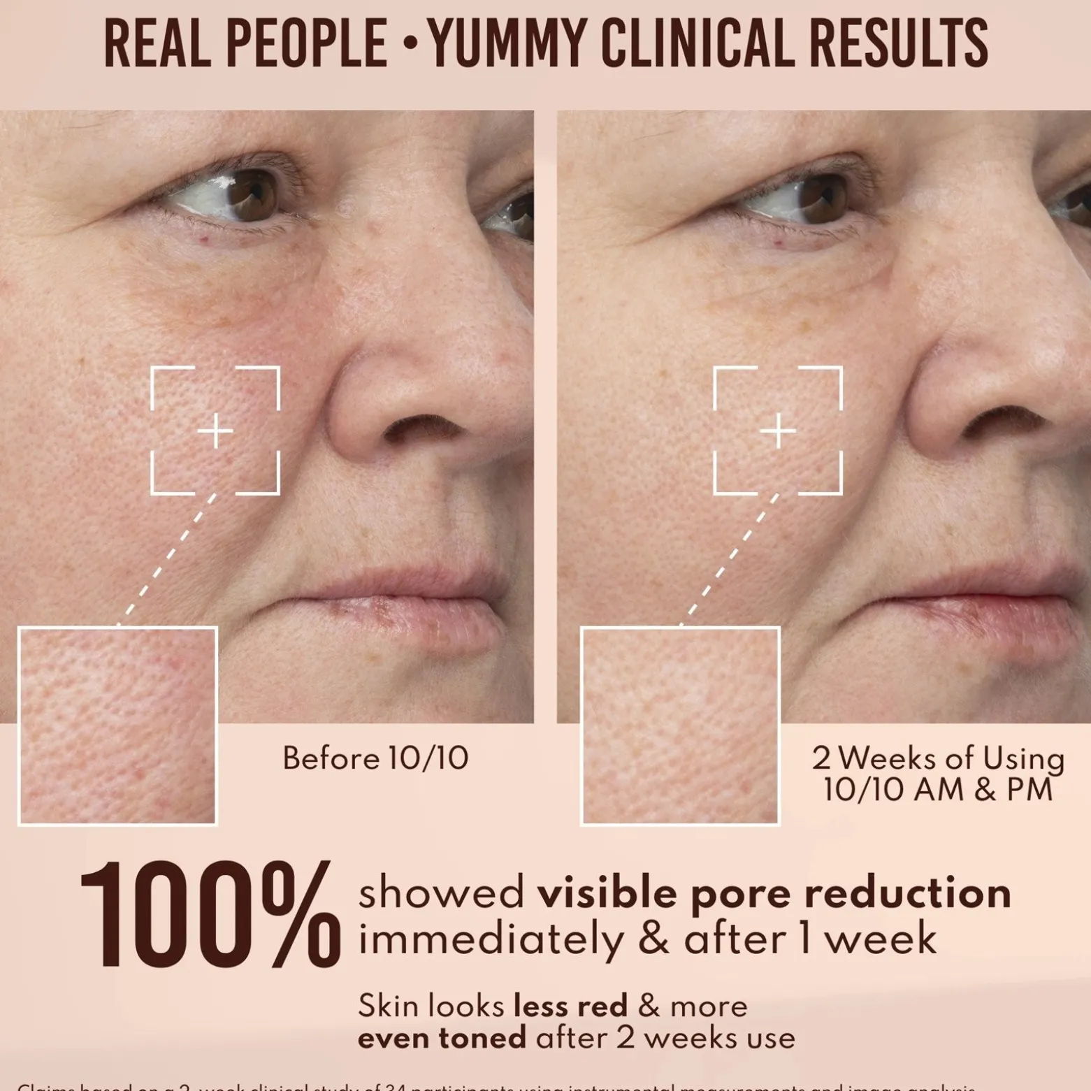 Danessa Myricks Beauty Yummy Skin 10/10 Barrier Boost Hyaluronic Acid + Ectoin Plumping Serum 50ml (1.69floz)
