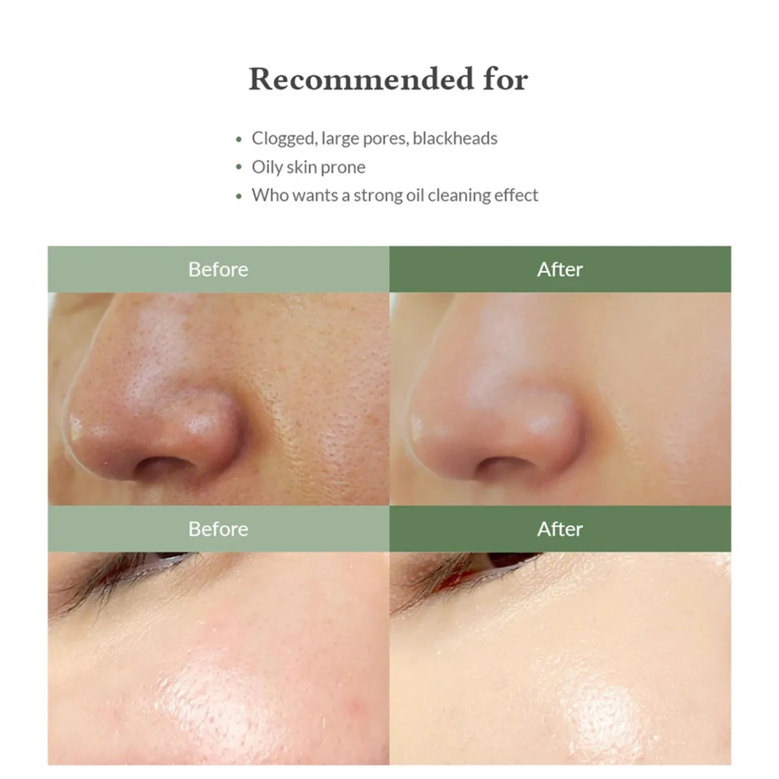 Dr. Althea Premium Quick Step Sebum Cleanser 100ml (3.38floz)