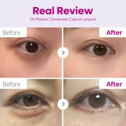 Dr.Melaxin Cemenrete Calcium Intense Ampoule Plus 30ml (1.01floz)