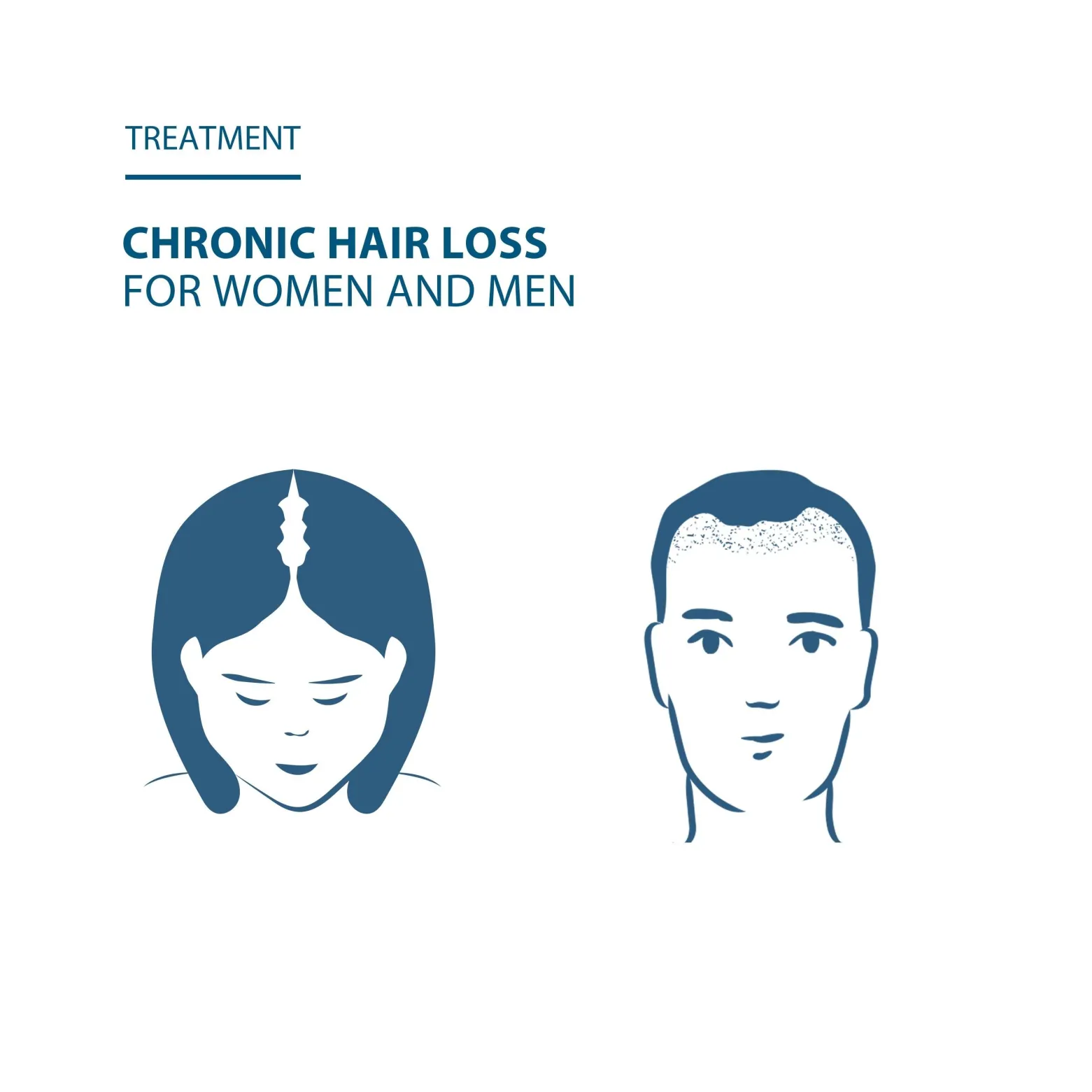 Ducray Anacaps Expert for Chronic Hair Loss 3x30