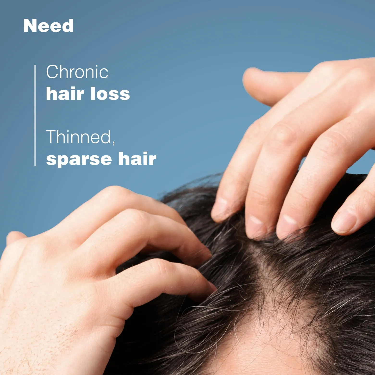 Ducray Anaphase Anti-Hair Loss & Anti-Thinning Shampoo 400ml (13.53floz)