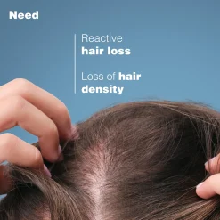 Ducray Anaphase Creastim Anti-Hair Loss & Growth Lotion 60ml (2.02floz)