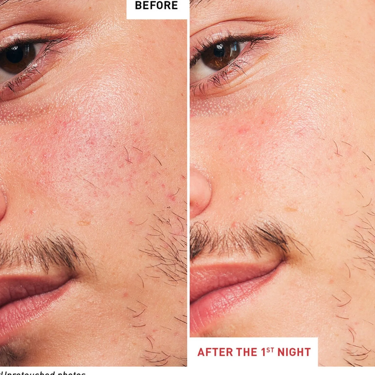 Erborian Skin Therapy Multi-Perfecting Night Oil 30ml (1floz)