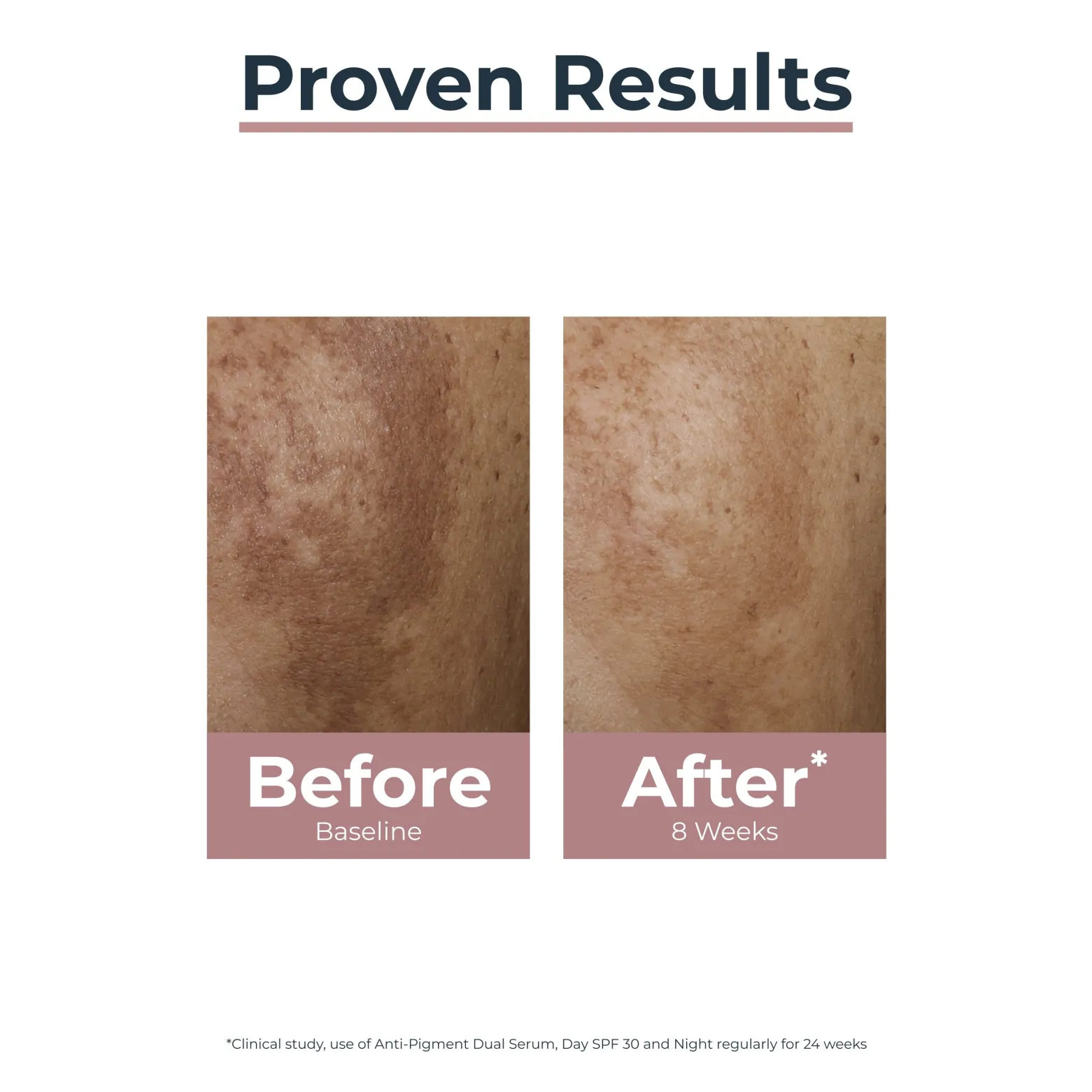 Eucerin Anti-Pigment Day Cream SPF30 Dark Spots 50ml (1.69floz)