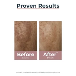 Eucerin Anti-Pigment Night Care Dark Spots 50ml (1.69floz)