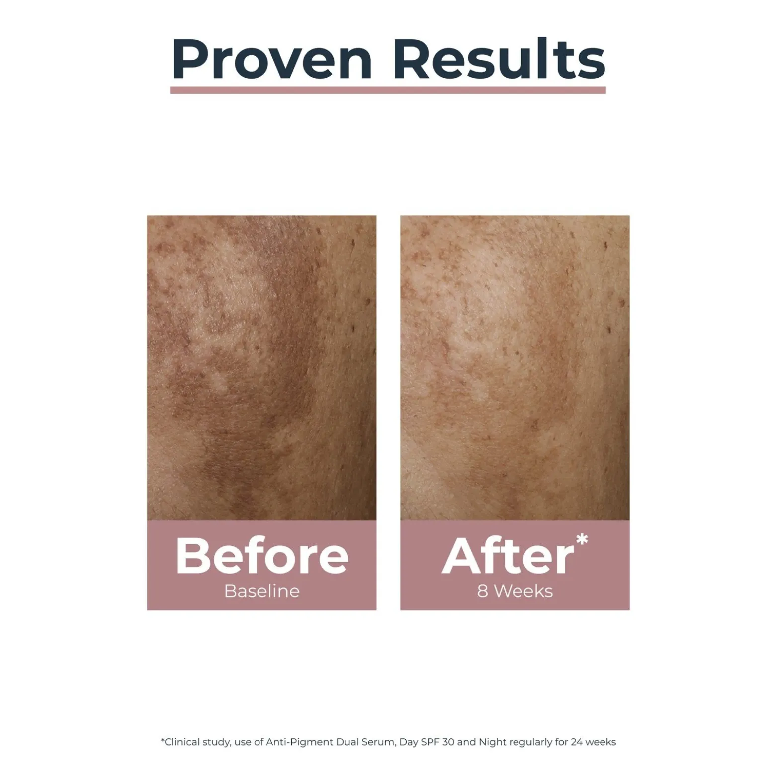 Eucerin Anti-Pigment Night Care Dark Spots 50ml (1.69floz)