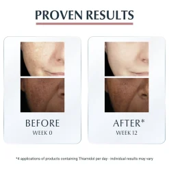 Eucerin Anti-Pigment Spot Corrector Dark Spots 5ml (0.17floz)