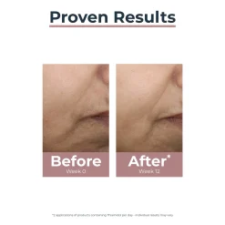 Eucerin Anti-Pigment Tinted Day Cream SPF30 Medium Dark Spots 50ml (1.69floz)