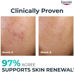 Eucerin DERMOPURE Clinical Peeling 10 40ml (1.35floz)