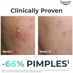 Eucerin DERMOPURE Oil Control Triple Effect Serum Acne-Prone Skin 40ml (1.35floz)