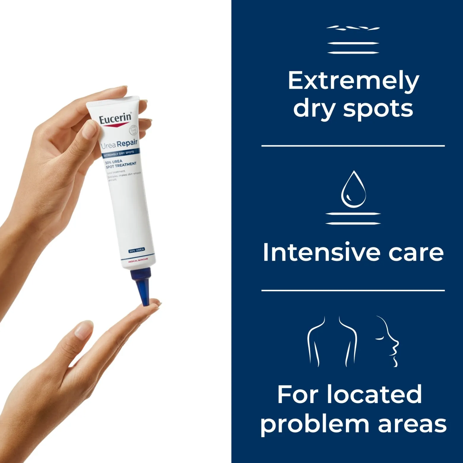 Eucerin UreaRepair Plus Cream 30% Urea 75ml (2.54floz)