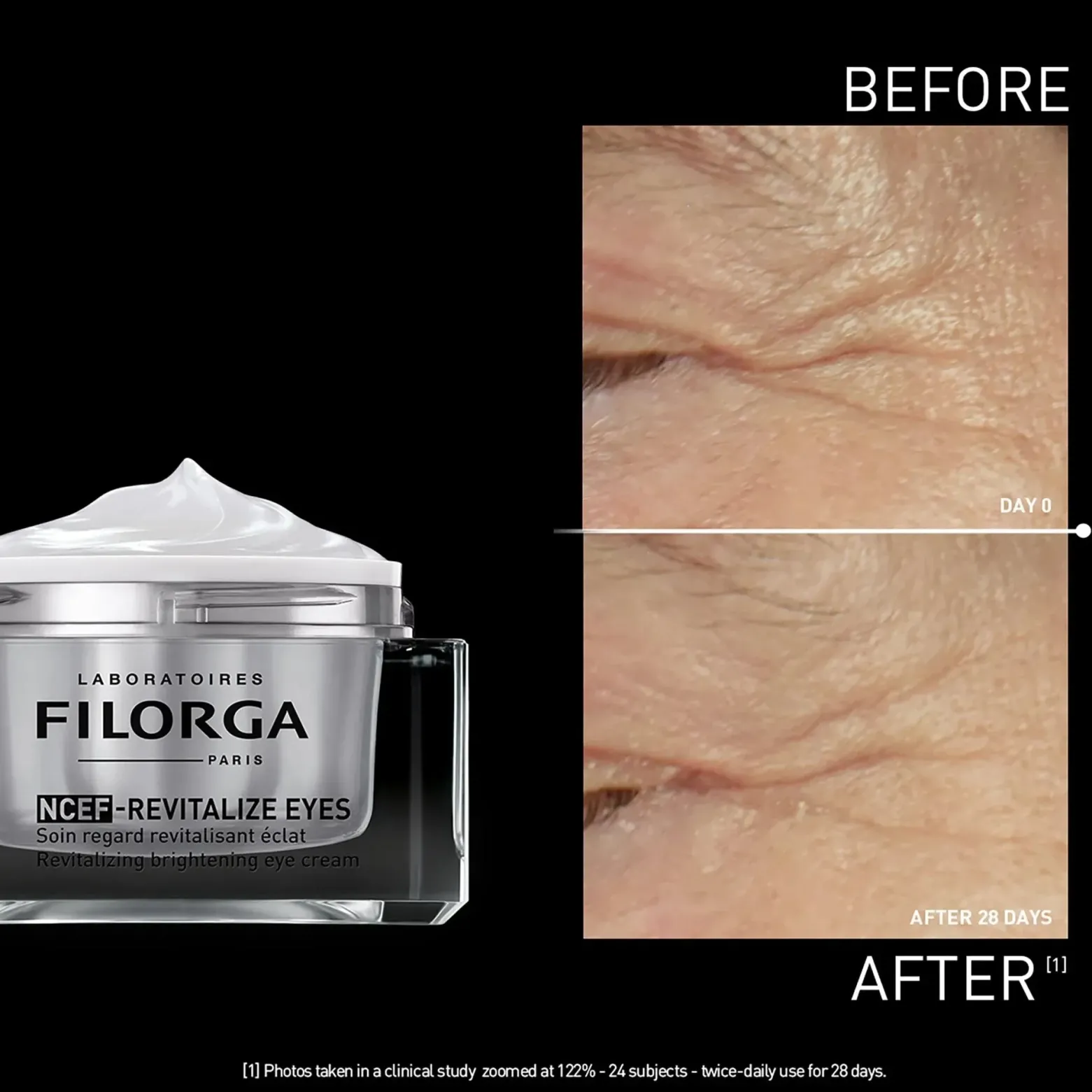 Filorga NCEF-Revitalize Eyes Brightening Eye Cream 15ml (0.5floz)