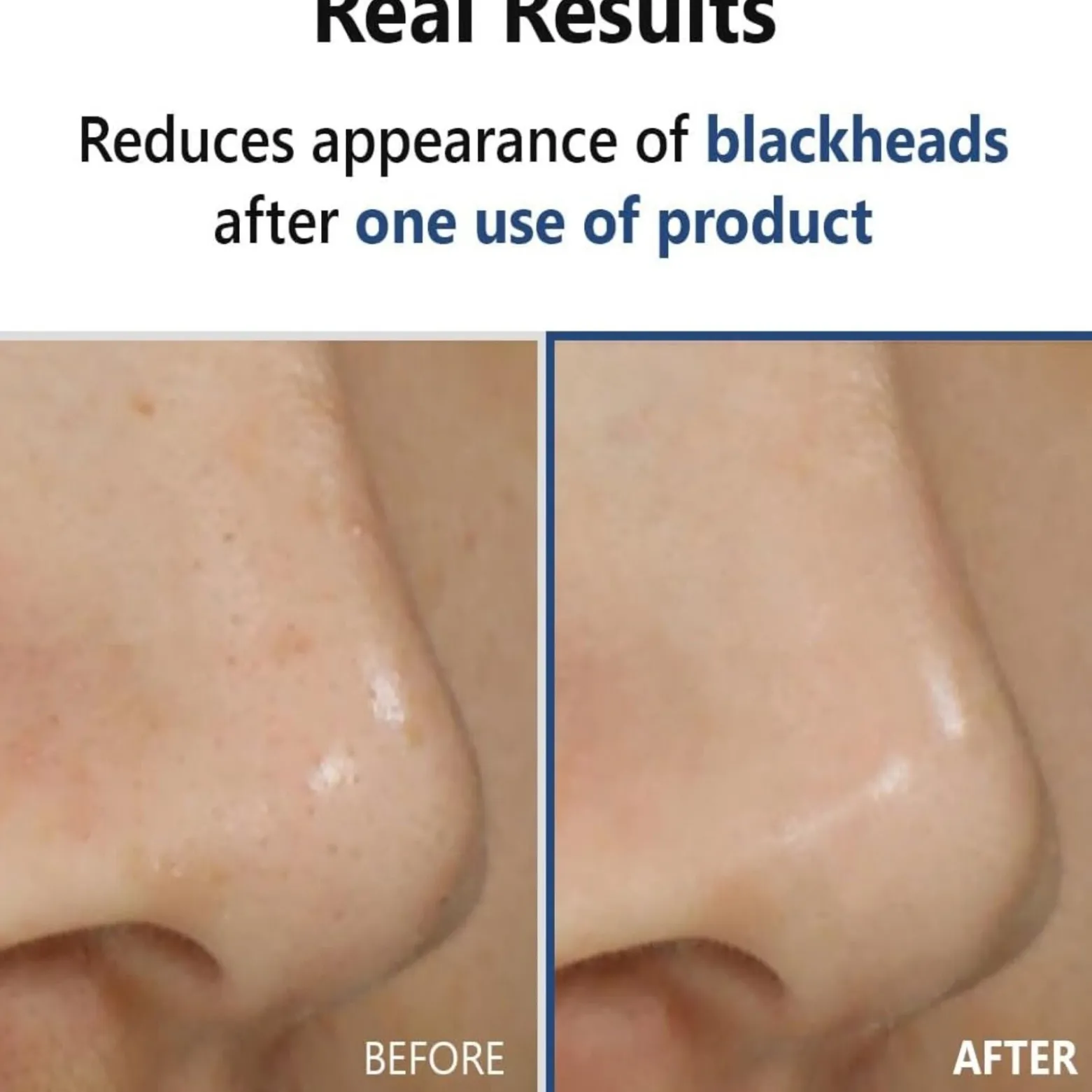 Isntree Hyper ACID4 30 Serum 20ml (0.67floz)