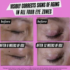 Kiehl's Super Multi-Corrective Eye Zone Treatment 28ml (0.95floz)