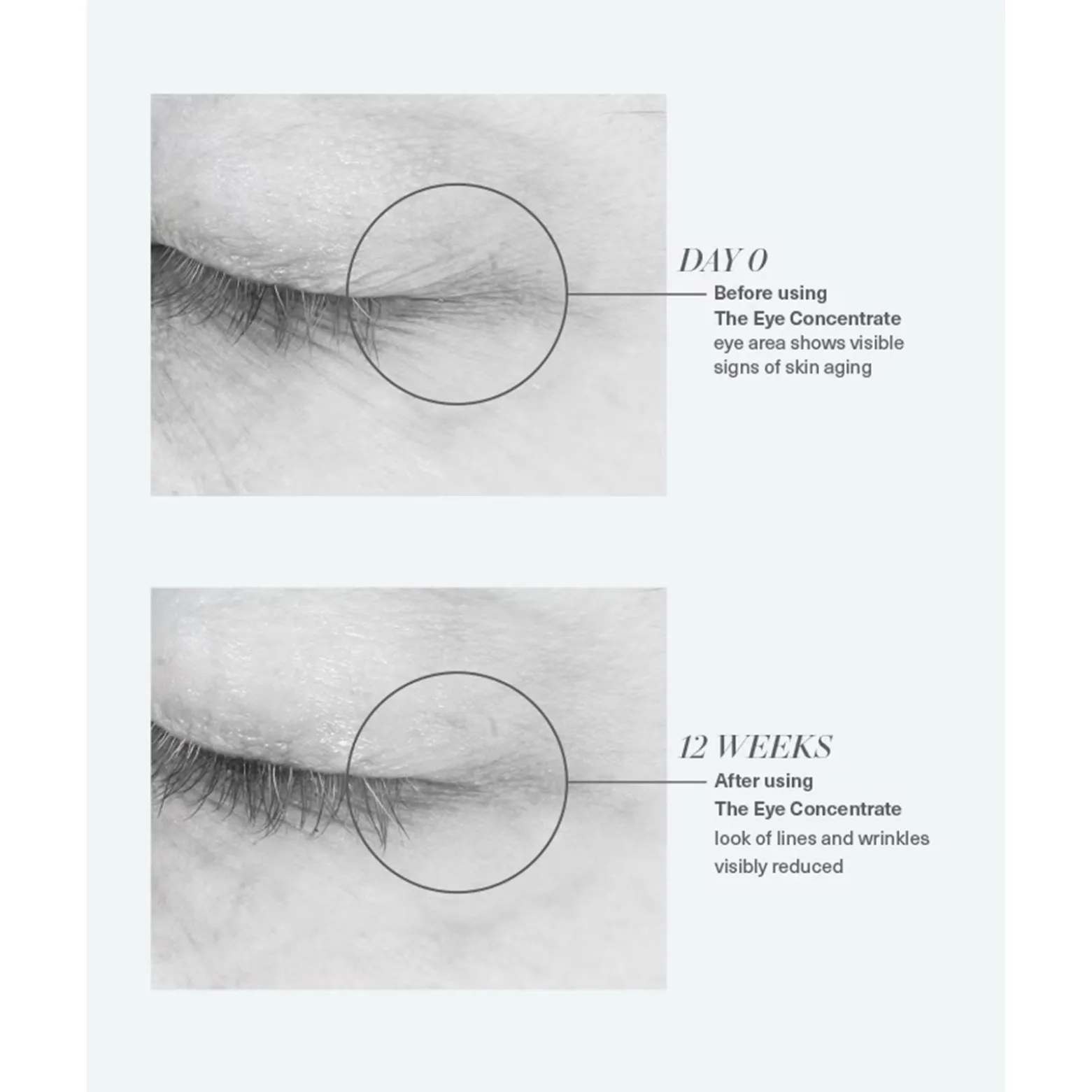 La Mer The Eye Concentrate 15ml (0.50floz)
