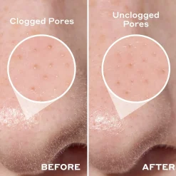 Mario Badescu 2-In-1 Deep Cleansing Pore Strip x6