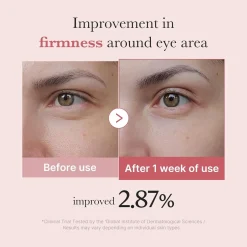 Medicube PDRN Pink Peptide Eye Cream 30ml (1.01floz)