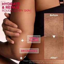 Mixa Urea Cica Repair+ Renewing Cream 400ml (13.5floz)