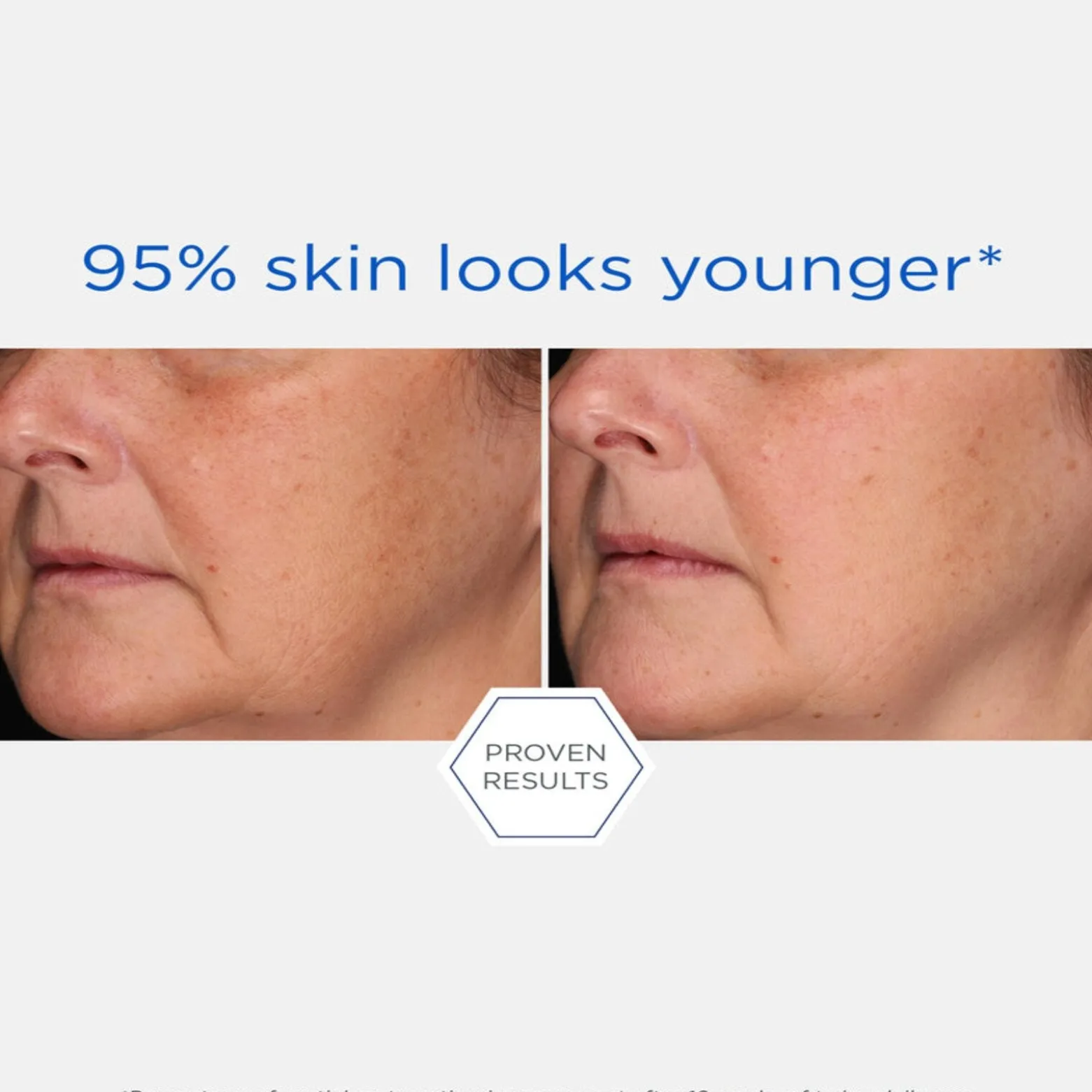 Neostrata Skin Active Repair Rebound Sculpting Cream 50g (1.76oz)