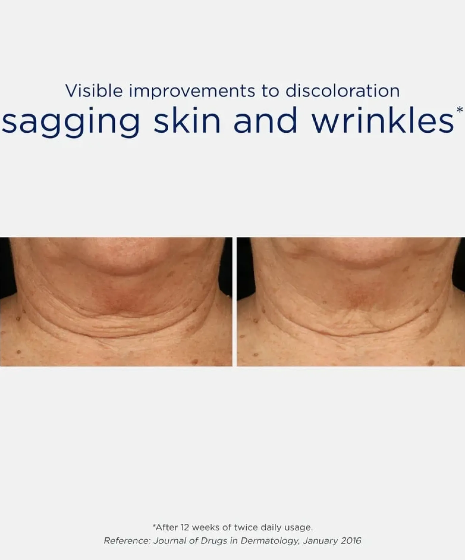 NeoStrata Skin Active Triple Firming Neck Cream 80g (2.82oz)