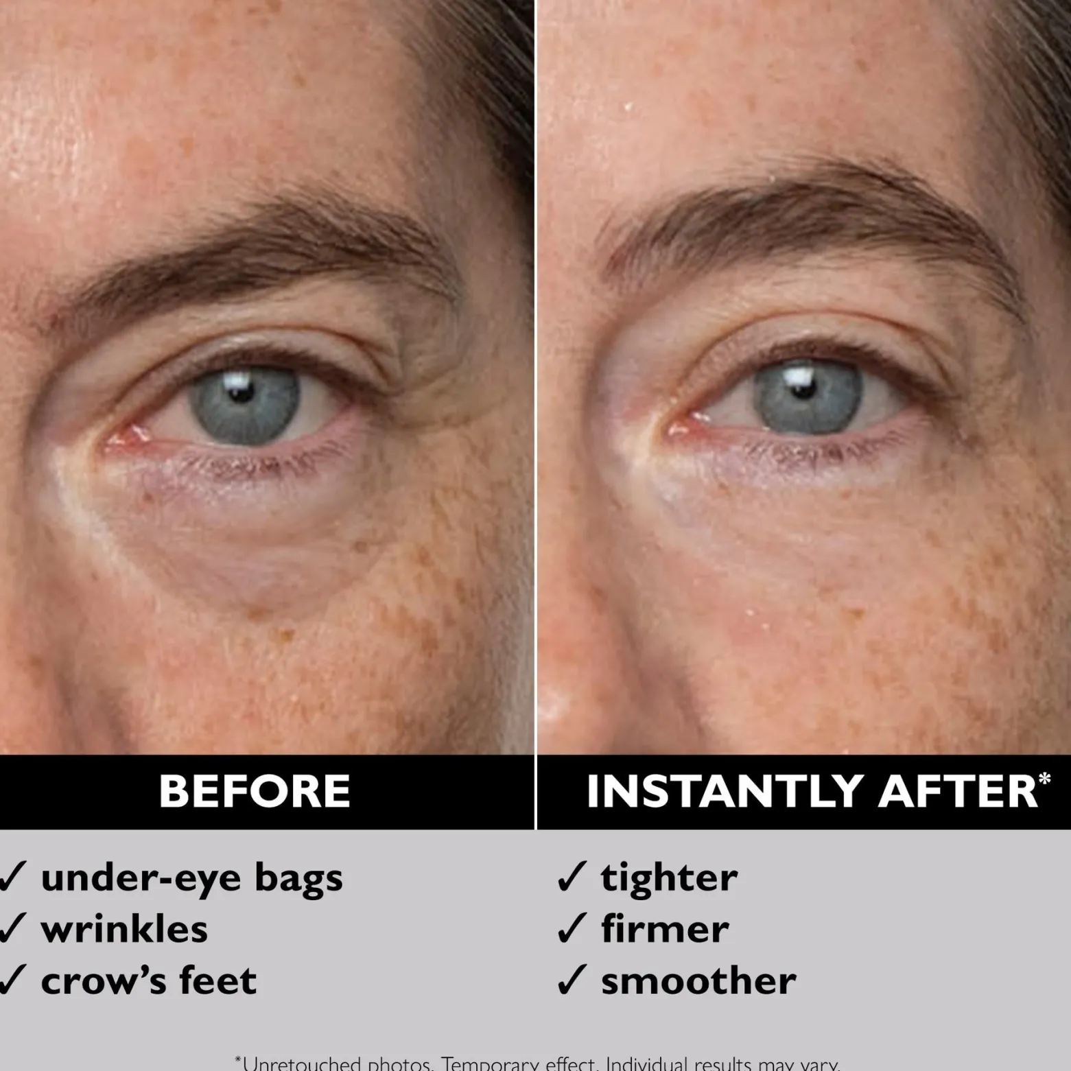 Peter Thomas Roth Instant FIRMx Eye Temporary Eye Tightener 30ml (1floz)