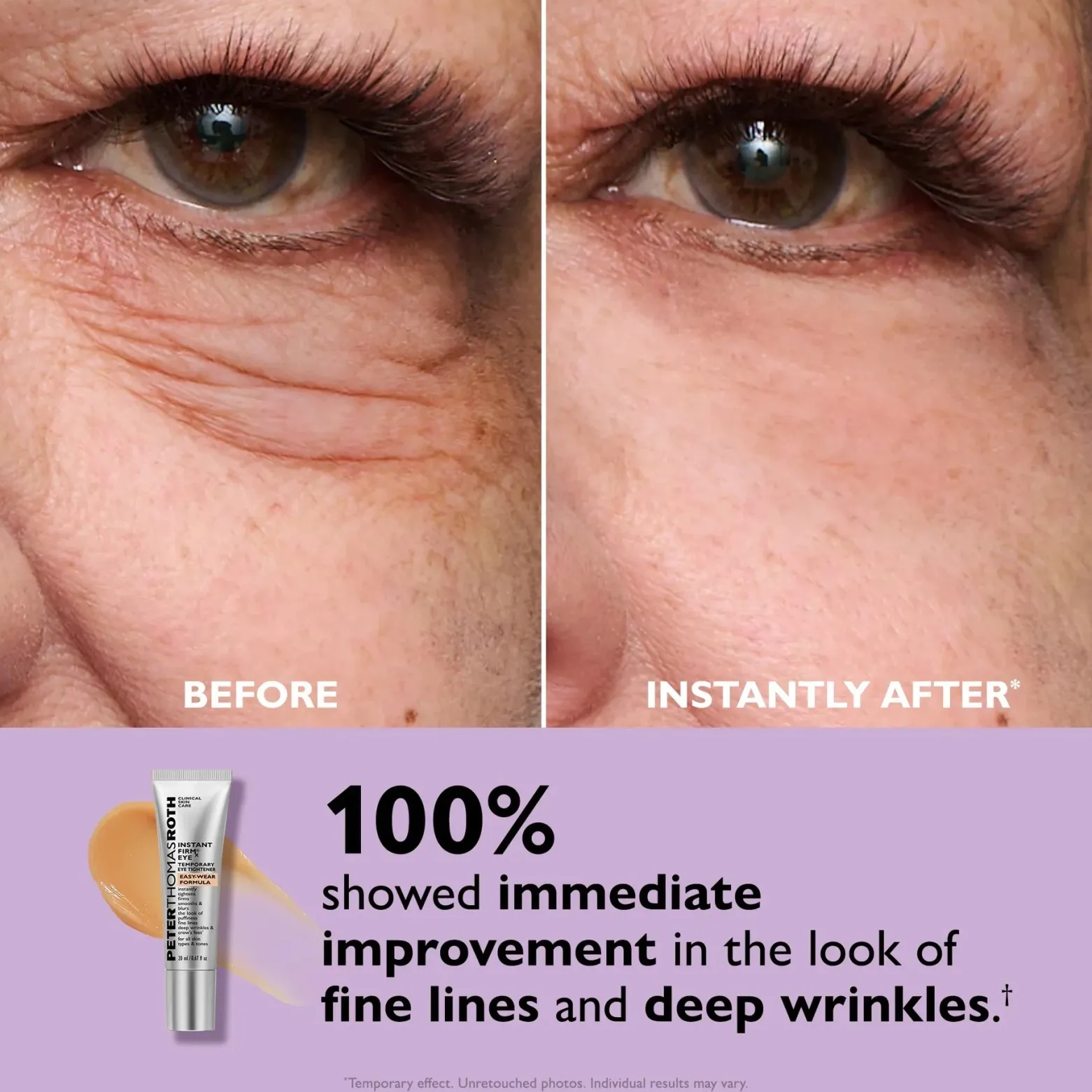 Peter Thomas Roth Instant FIRMx Eye Temporary Eye Tightener Easy-Wear Formula 20ml (0.67floz)