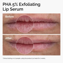 The Ordinary PHA 5% Exfoliating Lip Serum 15ml (0.5floz)
