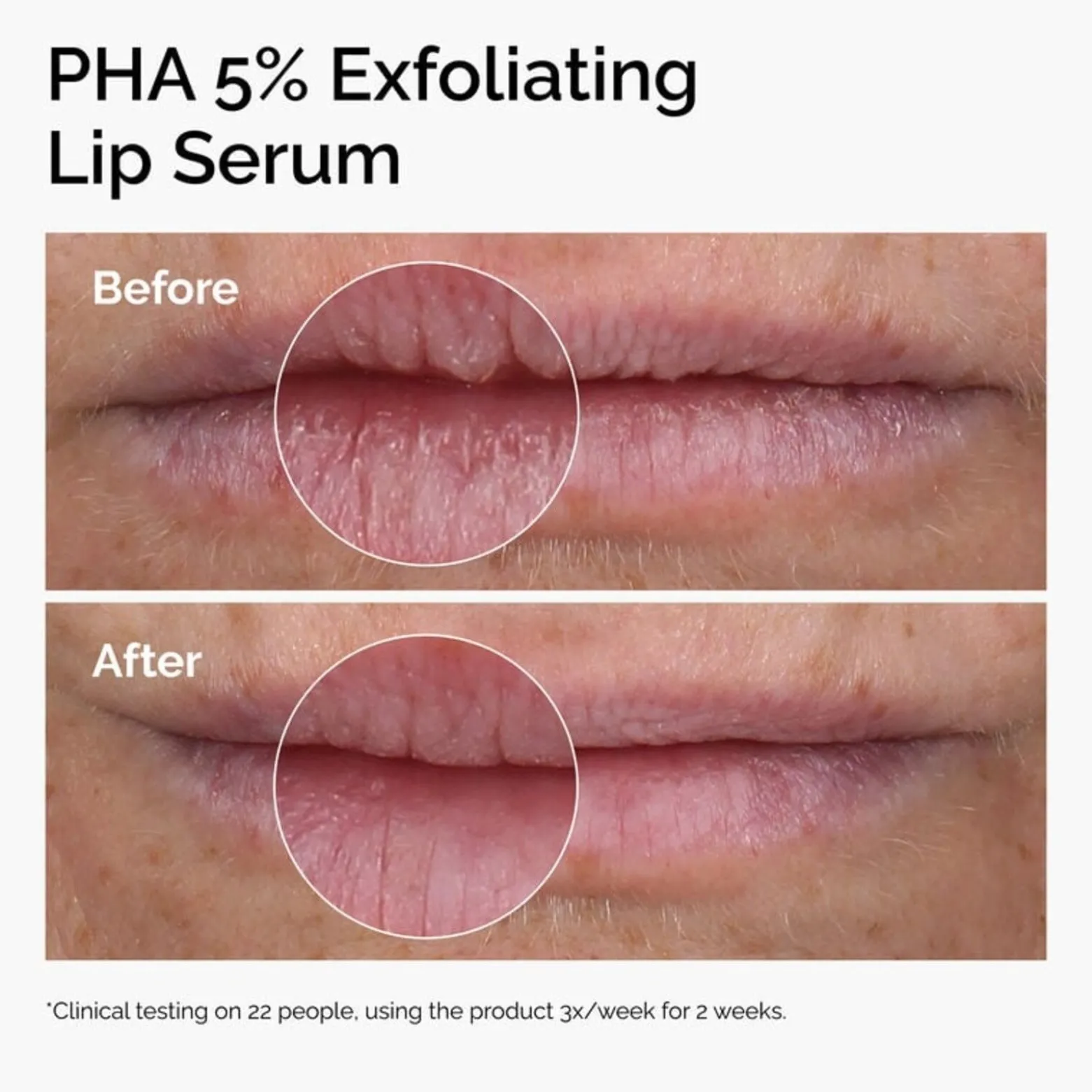 The Ordinary PHA 5% Exfoliating Lip Serum 15ml (0.5floz)