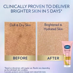 Vaseline Gluta-Hya Dewy Radiance Serum Burst Lotion 200ml (6.76floz)