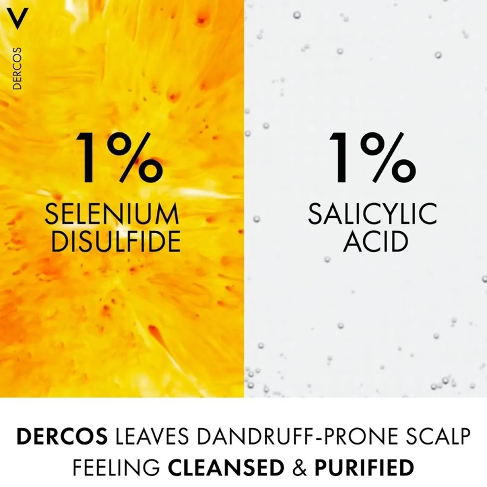 Vichy Dercos Anti-Dandruff DS Shampoo for Normal to Oily Hair 390ml (13.19fl oz)