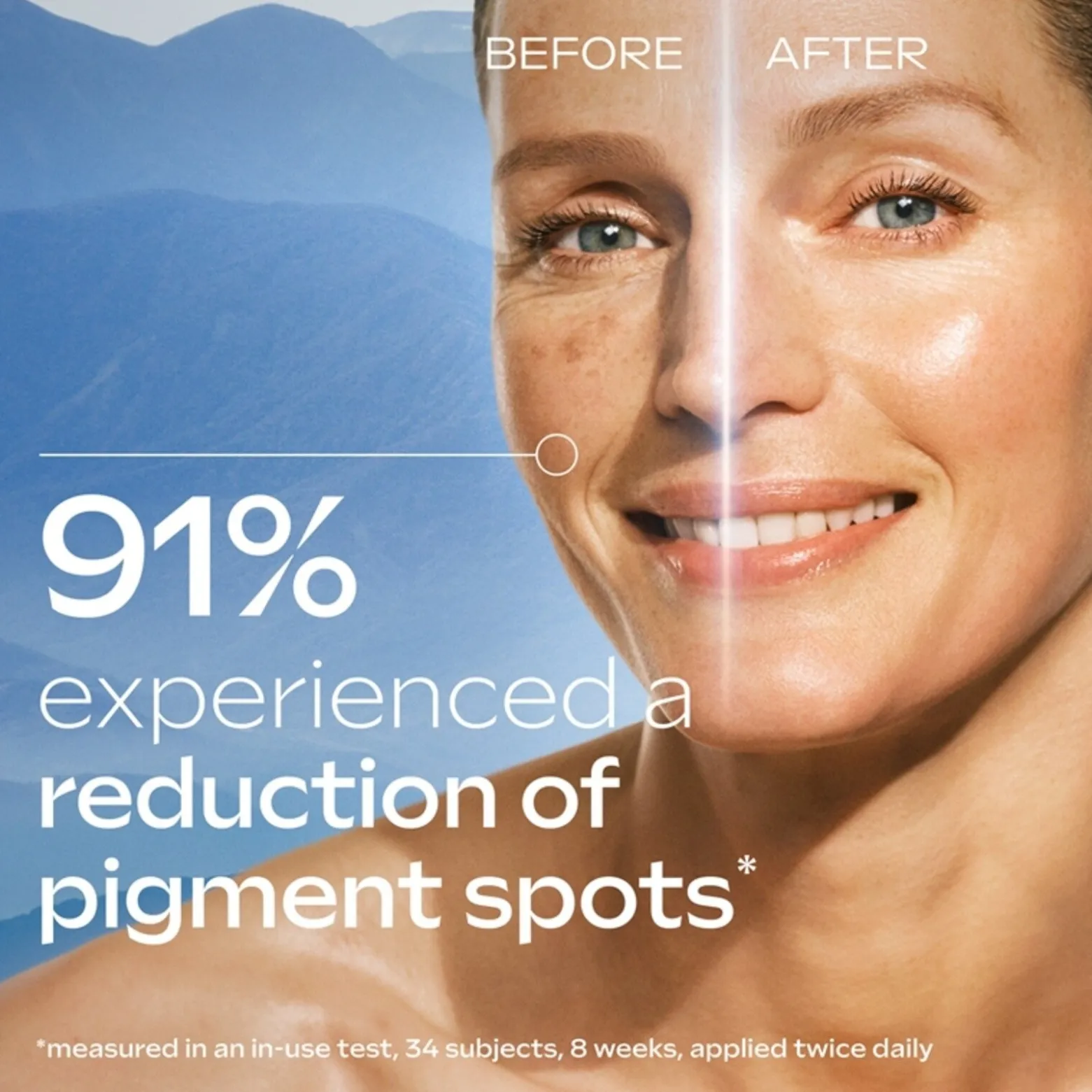 Weleda Anti-Pigmentation Brightening Serum 30ml (1floz)